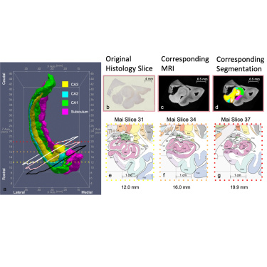 Decomposed dynamical systems models